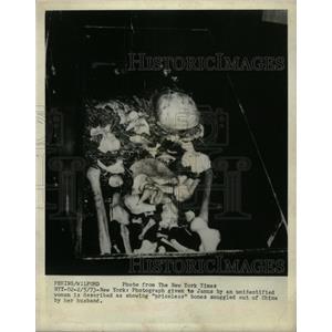 1973 Press Photo Priceless Bones Smuggles Out of China - RRX74245