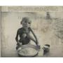1975 Press Photo Bengali Child CARE Malnutrition India - RRX84185